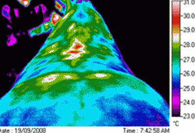 Thermographic image